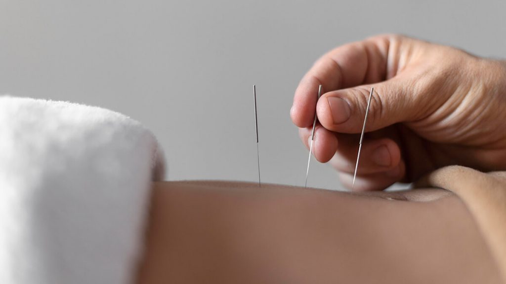 sains terkait akupuntur | | Mengenal Pengobatan Akupuntur Dan 6 Manfaatnya Untuk Kesehatan