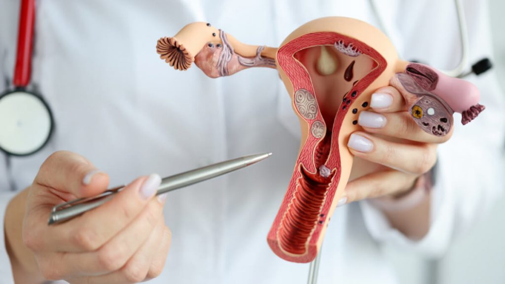 cara mengatasi vagina gatal menurut dokter